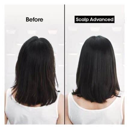 شامپو لورال اسکلپ ادونس سری اکسپرت